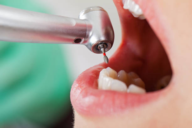 Best Pediatric Emergency Dentist in Rochester, NY